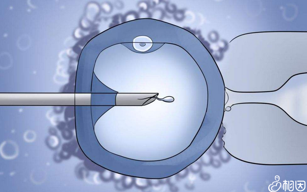 辅助生殖技术应对不育不孕挑战
